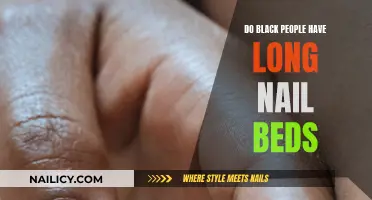 Black Nail Beds: Nature's Long Gift