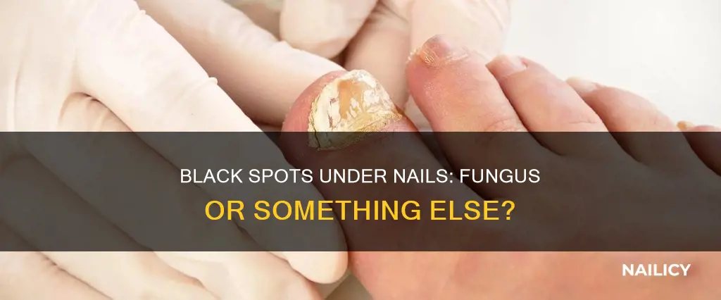 do black spots under nails mean fungus