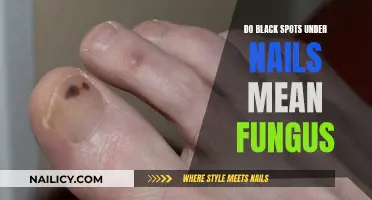 Black Spots Under Nails: Fungal Infection or Something Else?