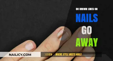 Brown Lines on Nails: Causes, Concerns, and Effective Removal Solutions