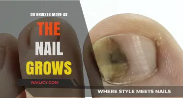 How Nails Growing Affects Bruises: What You Need to Know