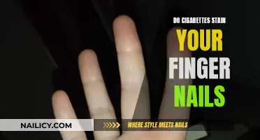 Cigarettes: Staining Nails and Health Risks