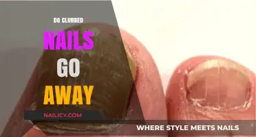 Clubbed Nails: Can They Be Reversed? Causes and Treatment Options