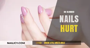 Do Clubbed Nails Cause Pain? Understanding Symptoms and Discomfort