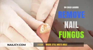 Cold Laser Nail Fungus Treatment: Does It Work?