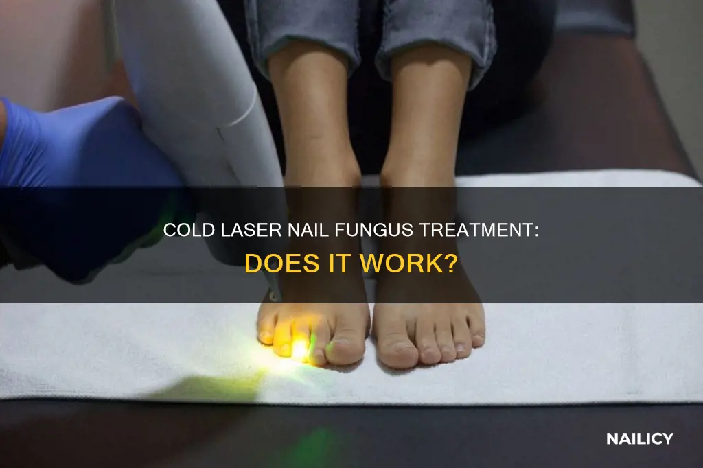 do cold lasers remove nail fungus