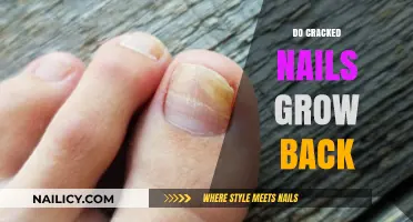 Cracked Nails: Can They Grow Back Healthy?