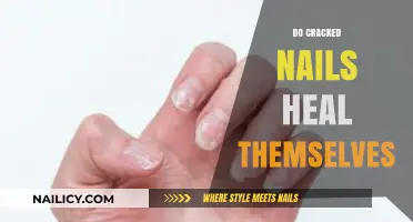 Can Cracked Nails Heal on Their Own? The Truth Revealed