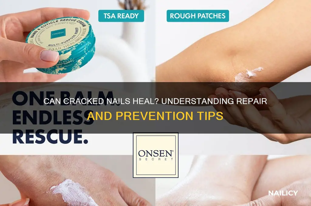 do cracked nails heal