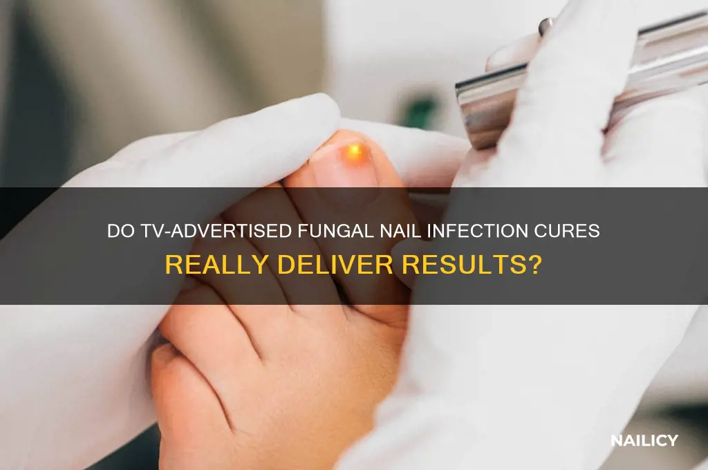 do cures for fungal nail infection tv work