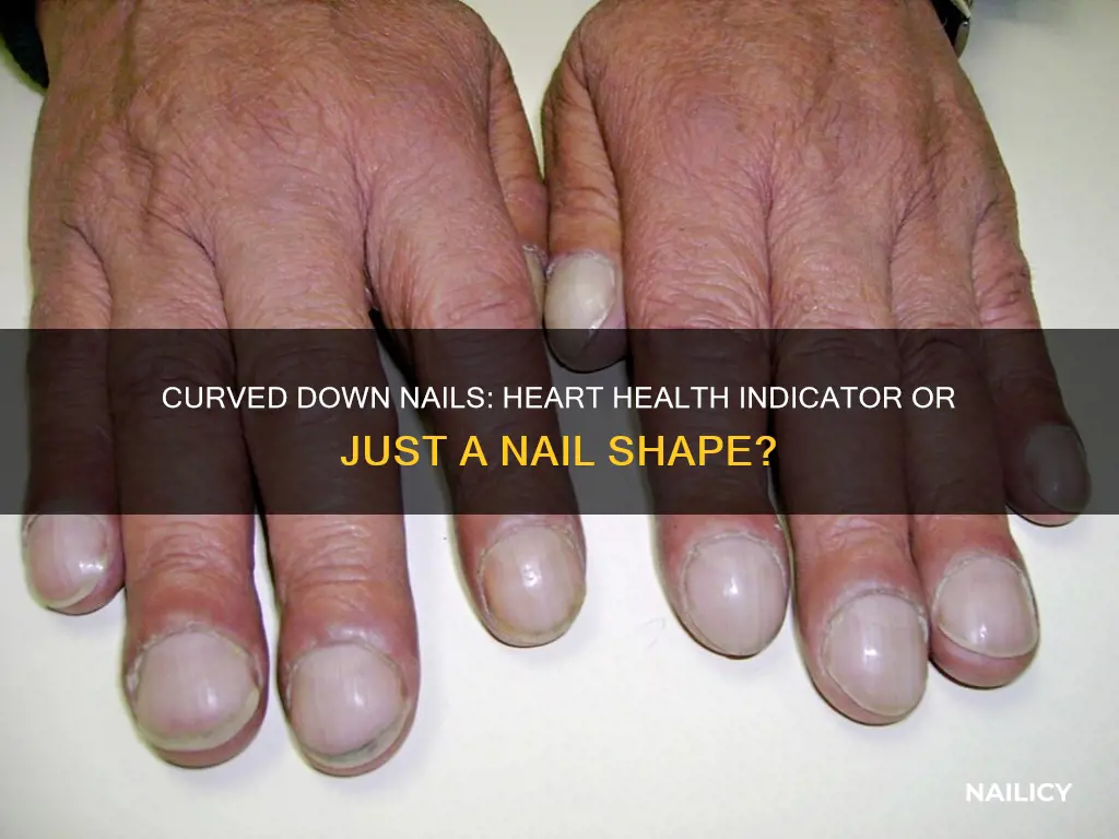 do curved down nails mean heart issues