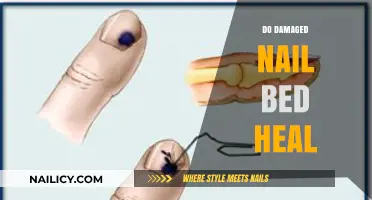 Can Damaged Nail Beds Heal? Understanding Recovery and Care Tips