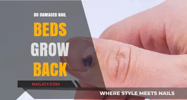 Damaged Nail Beds: Can They Grow Back?