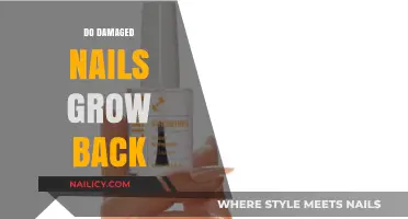 Damaged Nails: Can They Grow Back Healthy?