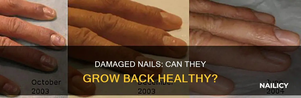 do damaged nails grow back