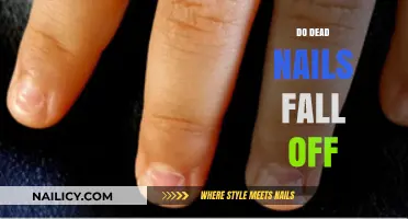 Do Dead Nails Fall Off? Understanding Nail Health and Shedding