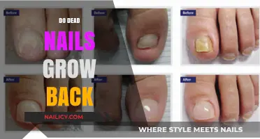 How to Get Your Nails Growing Back After They Fall Off