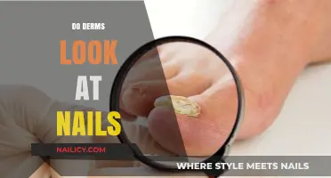Do Dermatologists Examine Nails? Uncovering the Role of Nail Health in Skin Care
