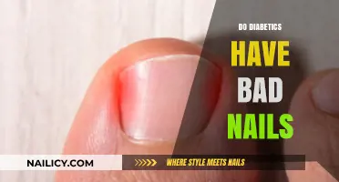 Diabetic Nail Health: Understanding Changes and Care Tips