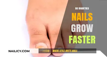 Diabetics' Nail Growth: A Surprising Symptom