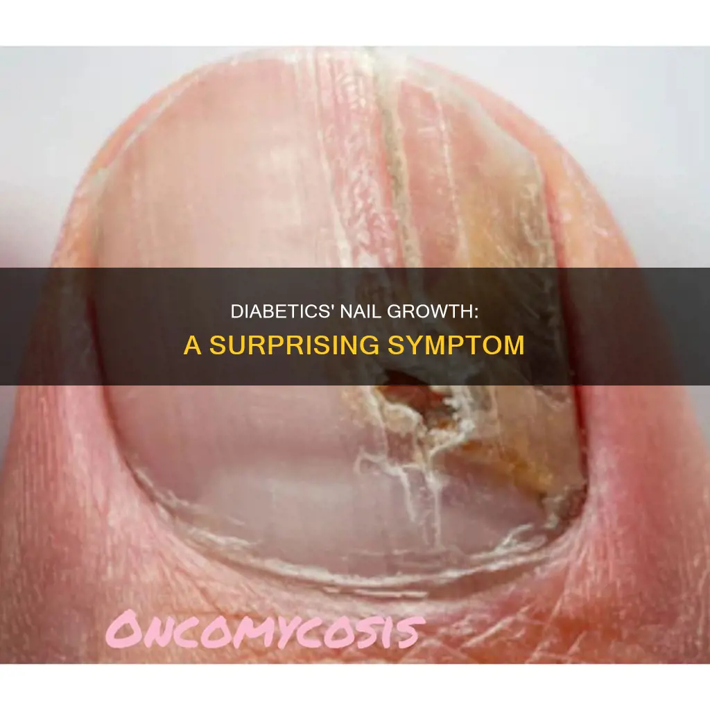 do diabetics nails grow faster