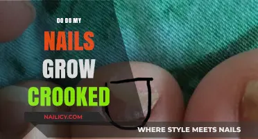 Why Nails Grow Crooked and How to Fix Them