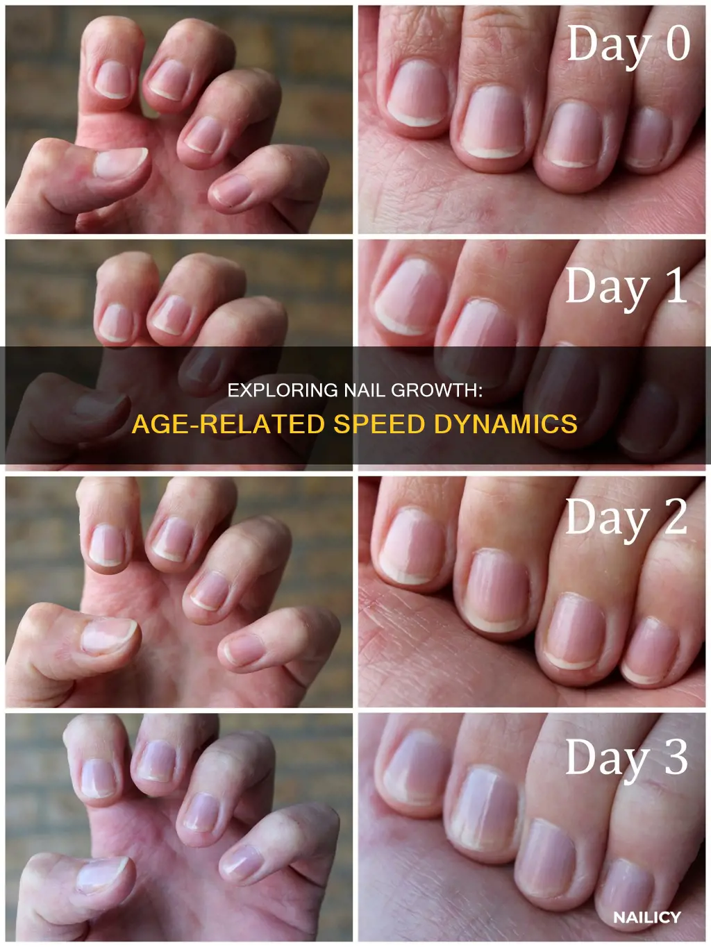 do finger and toe nails grow faster with age