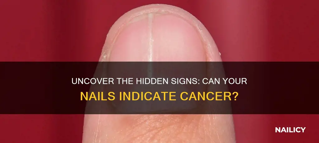 do finger nails show signs of cancer