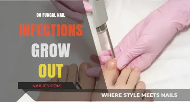 Fungal Nail Infections: Can They Grow Out?
