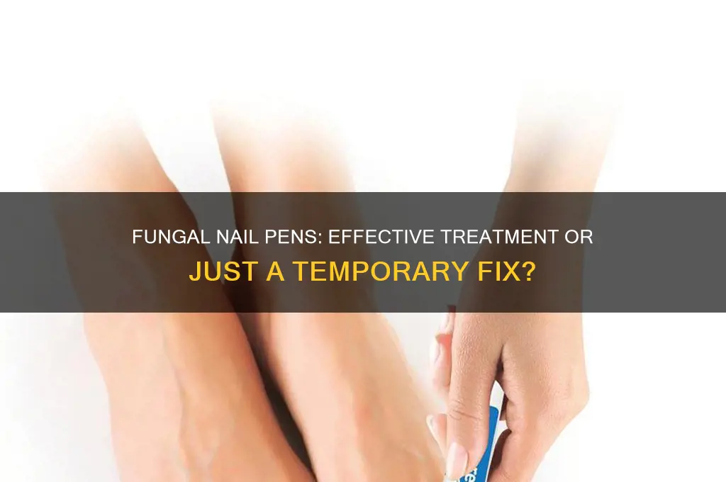 do fungal nail pens work