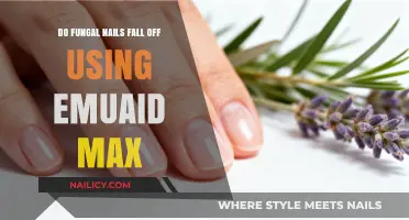 Treating Fungal Nails: Does Emuaid Max Cause Them to Fall Off?