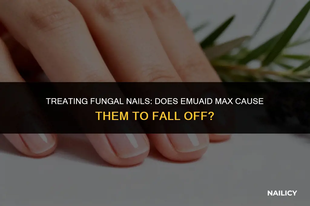 do fungal nails fall off using emuaid max