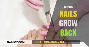 Fungal Nails: Can They Grow Back?