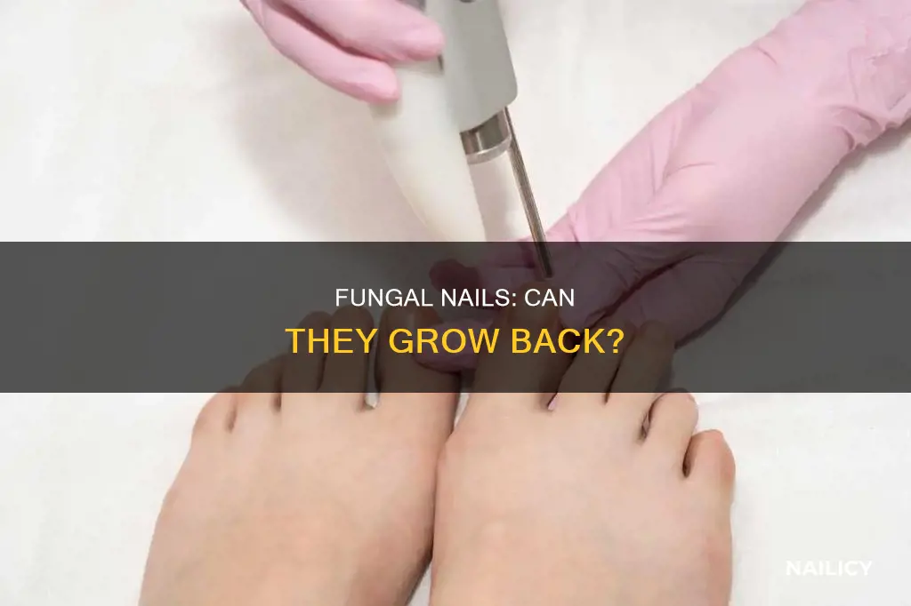 do fungal nails grow back