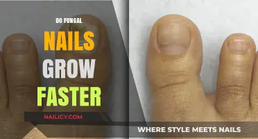 Fungal Nails: Faster Growth or Mere Illusion?
