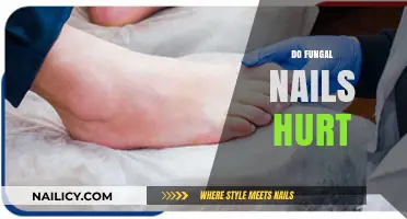 Do Fungal Nails Cause Pain? Understanding Symptoms and Treatment Options