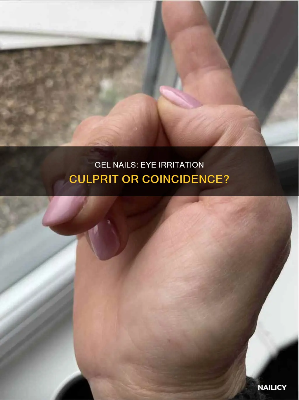 do gel nails cause eye irritation