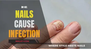 Gel Nails: Infection Risk and Prevention Tips