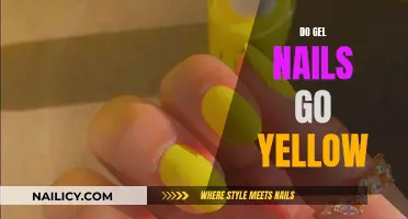 Gel Nails Turning Yellow: Why and How to Prevent It