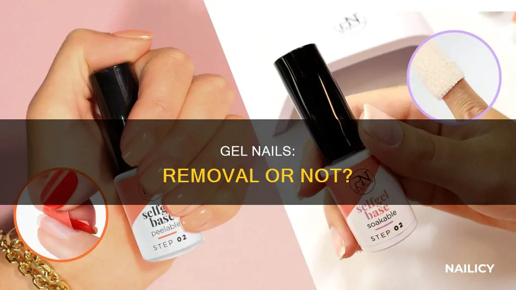 do gel nails need to be removed