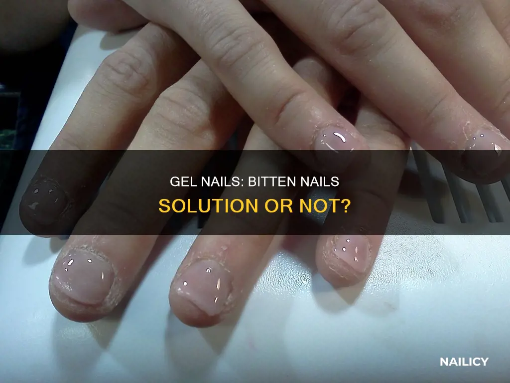 do gel nails work on bitten nails