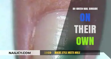 Do Green Nails Subside on Their Own? Understanding Causes and Remedies