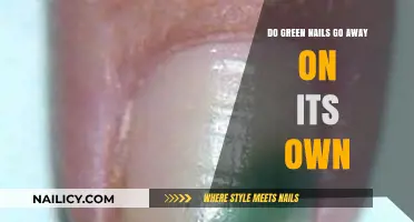 Will Green Nails Disappear Without Treatment? Understanding Causes and Solutions