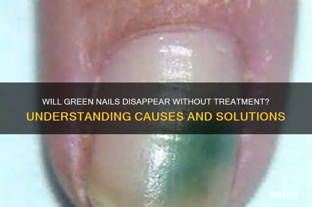 do green nails go away on its own