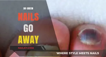 Do Green Nails Go Away? Causes, Solutions, and Prevention Tips