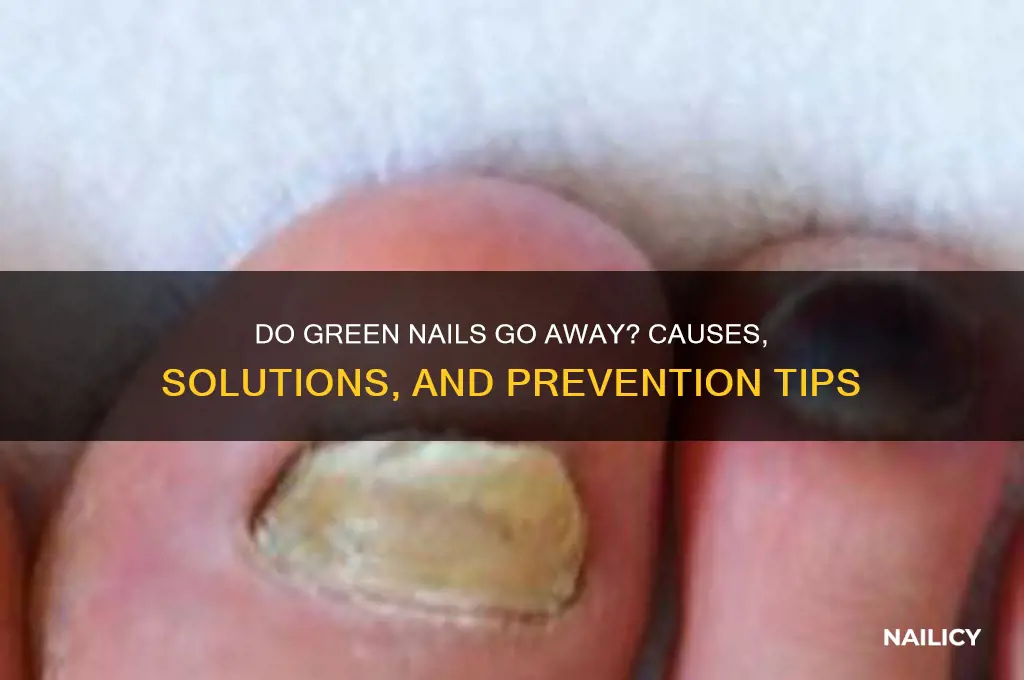 do green nails go away