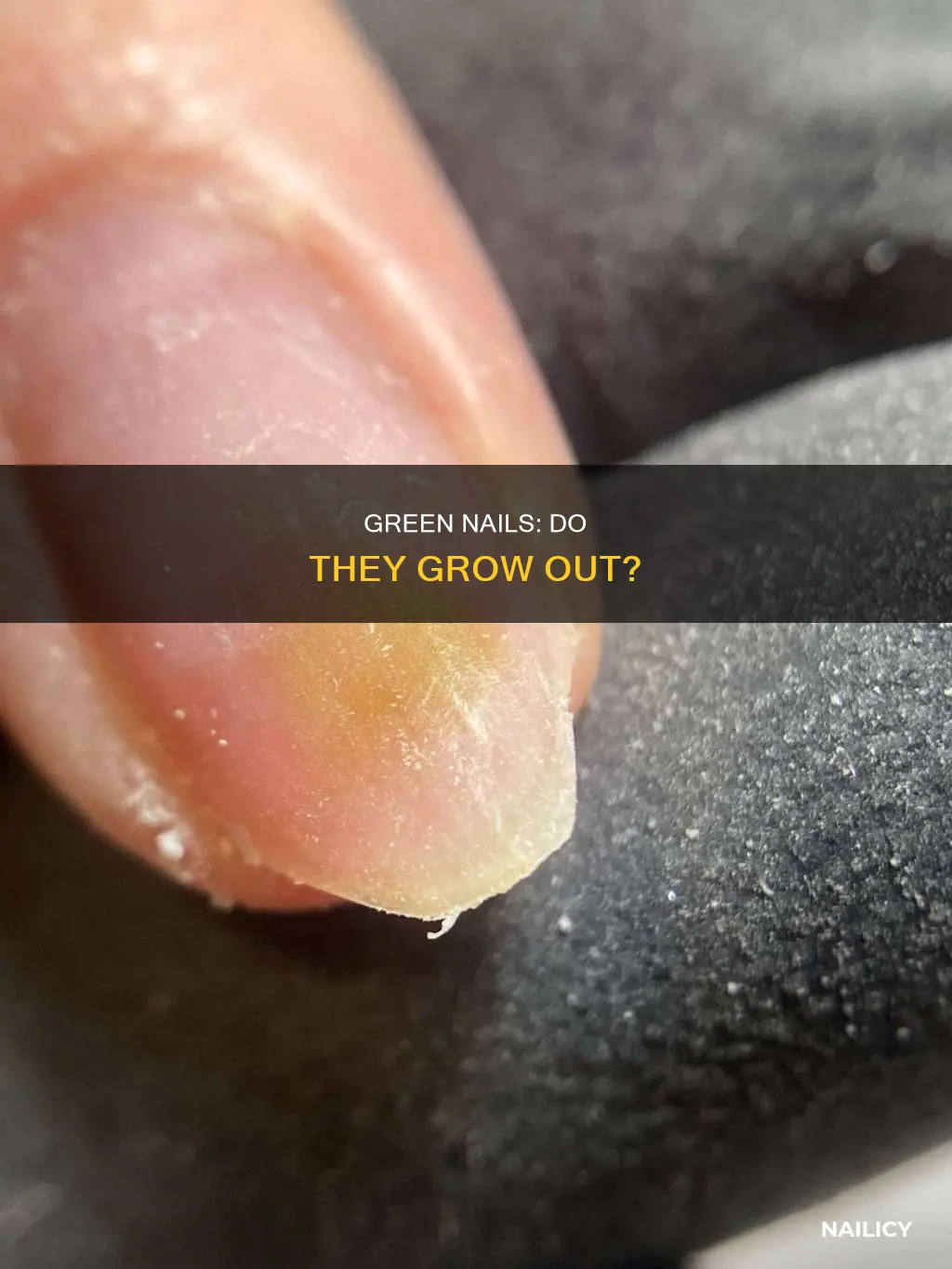 do green nails grow out