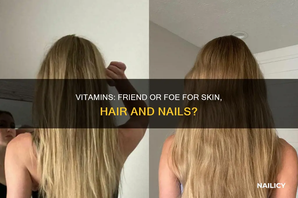 do hair skin and nail vitamins make you break out