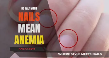 Half Moon Nails and Anemia: Unraveling the Mystery