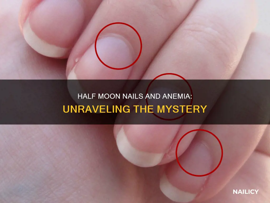 do half moon nails mean anemia